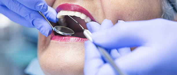 Best Emergency Dental Care for Abscessed Tooth in Caledonia, MS